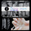 140pc 3D Diamond Soft Gel Nail Tips Style 12 Nail Art Designs image 0